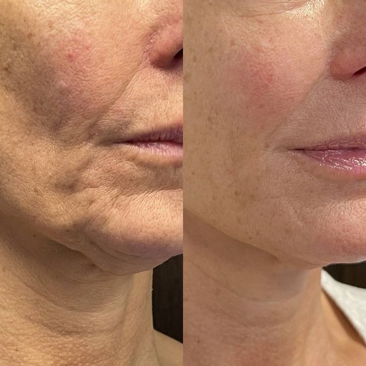 Okoa Lifting Cream