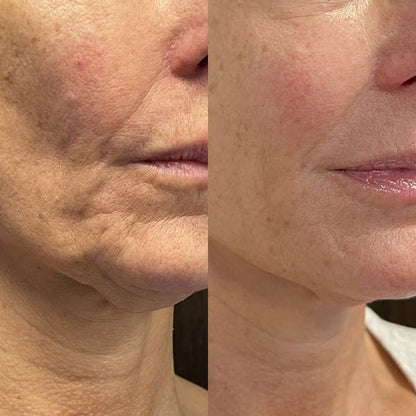 Okoa Lifting Cream - Delivery every 1 month