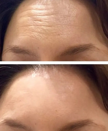 Okoa Lifting Cream - Delivery every 1 month