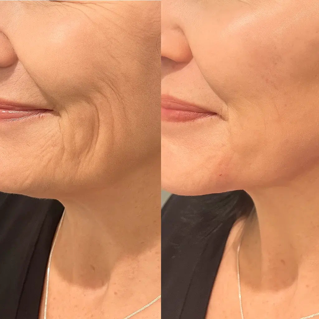 Okoa Lifting Cream
